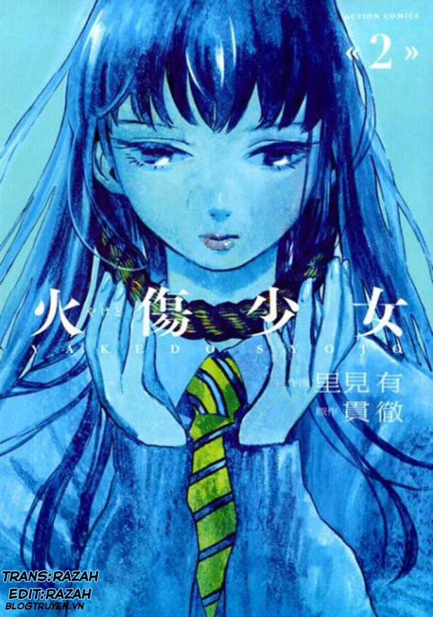 Yakedo Shoujo Chapter 7 trang 0